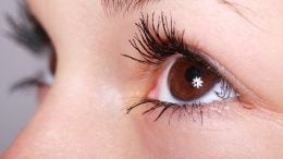 Herpes Zoster Ophthalmicus Facts And Fiction