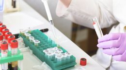 FDA Approves: New Rutgers Saliva Test