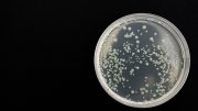 CDC Investigating E. coli Outbreak
